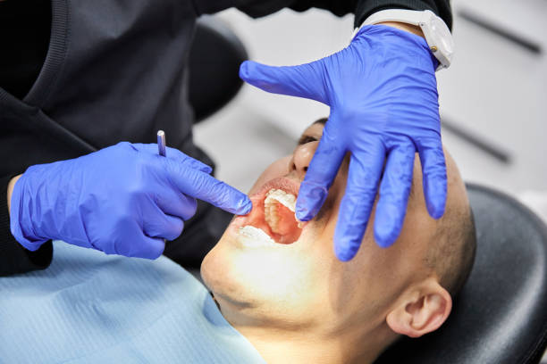 Best Emergency Dental Extractions in Berea, KY