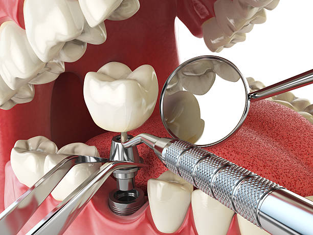 Best Emergency Dental Services for Seniors in Berea, KY
