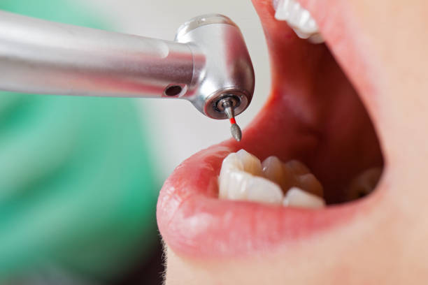 Best Emergency Dentist for Knocked-Out Tooth in Berea, KY